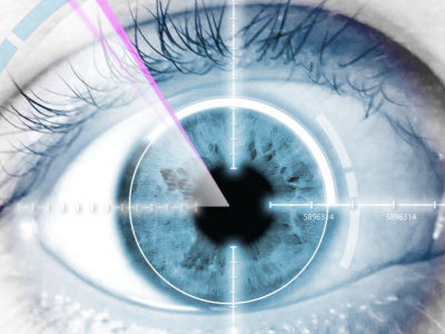 Laser Eye Surgery​